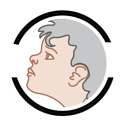 leczenie otyłości u dzieci i młodzieży